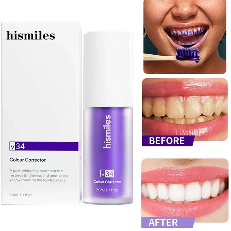 Teeth Whitening HiSmile V34 | ORIGINAL
