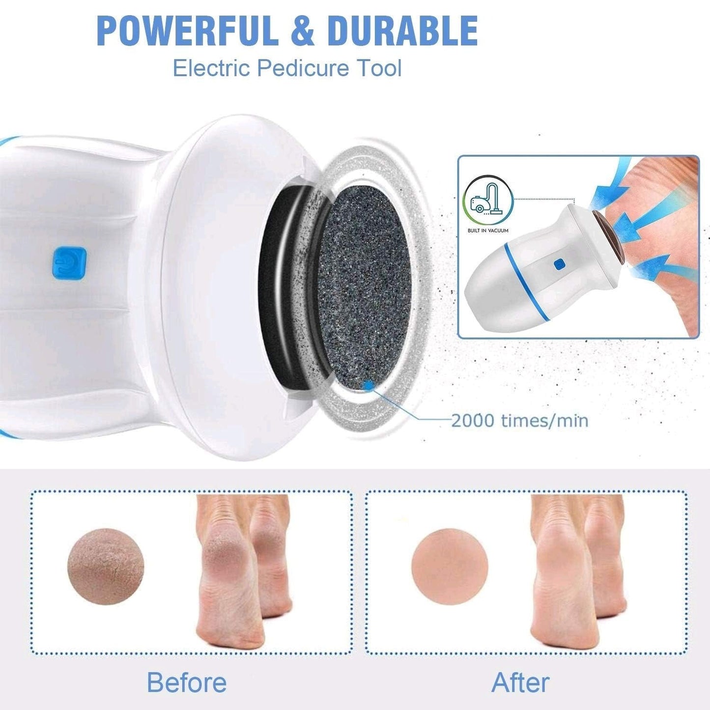 Electric Foot Grinder